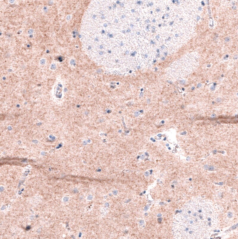 GPR88 Antibody (CL15190) [Unconjugated] Immunohistochemistry-Paraffin: GPR88 Antibody (CL15190) [NBP3-43656]