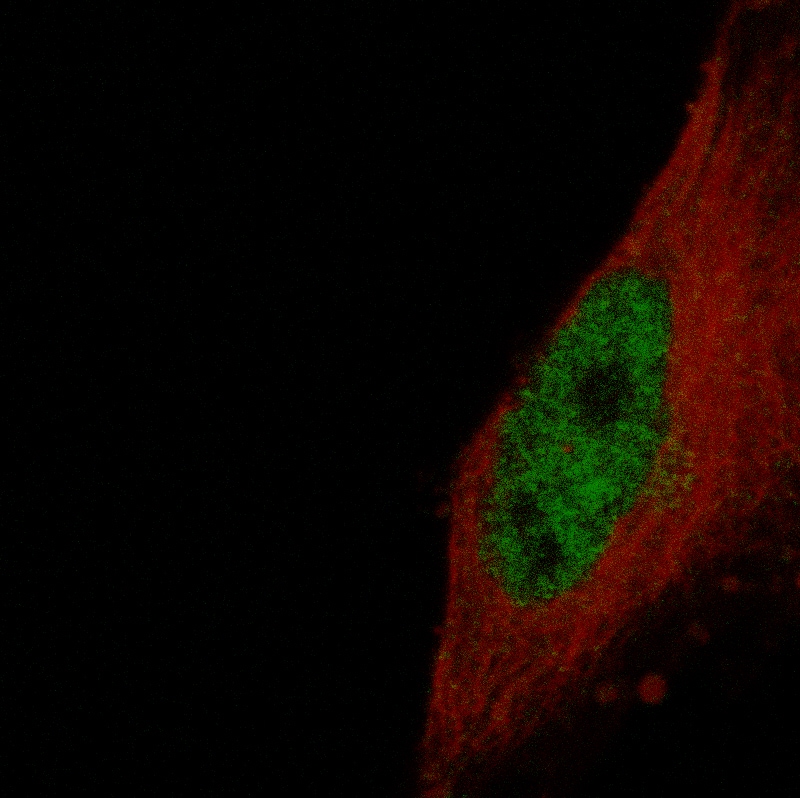 ETV1 Antibody (CL15251) [Unconjugated] Immunocytochemistry/ Immunofluorescence : ETV1 Antibody (CL15251) [NBP3-43657]