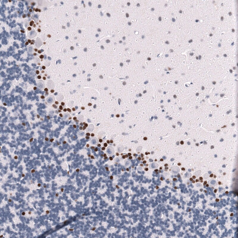 POU3F3 Antibody (CL15302) [Unconjugated] Immunohistochemistry-Paraffin: POU3F3 Antibody (CL15302) [NBP3-43659]