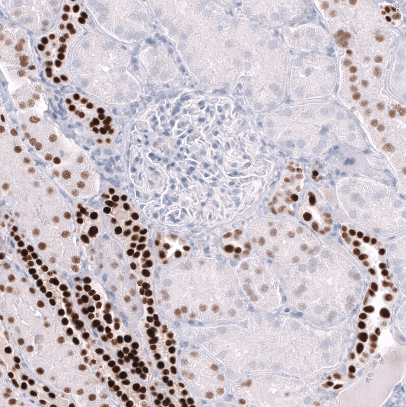 POU3F3 Antibody (CL15302) [Unconjugated] Immunohistochemistry-Paraffin: POU3F3 Antibody (CL15302) [NBP3-43659]