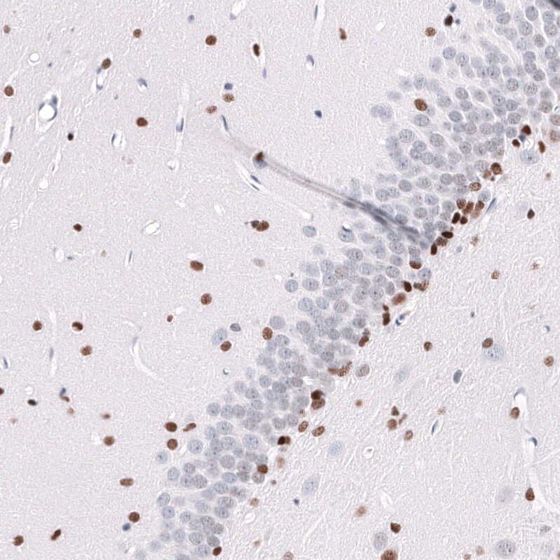 POU3F3 Antibody (CL15302) [Unconjugated] Immunohistochemistry-Paraffin: POU3F3 Antibody (CL15302) [NBP3-43659]