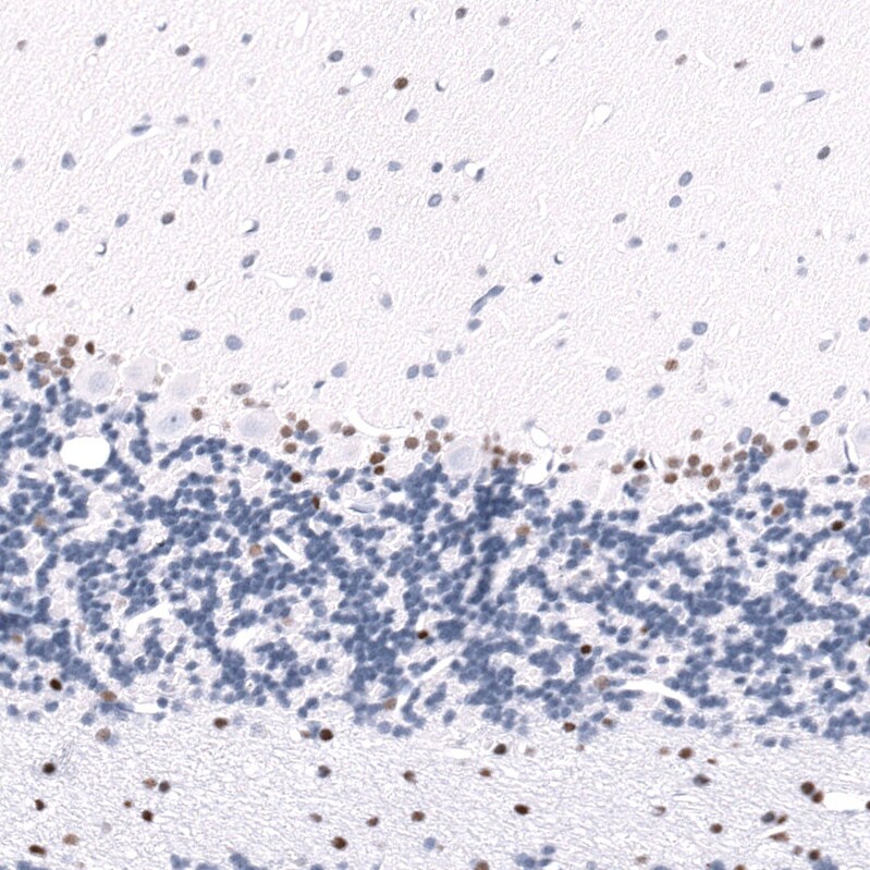 POU3F3 Antibody (CL15302) [Unconjugated] Immunohistochemistry-Paraffin: POU3F3 Antibody (CL15302) [NBP3-43659]