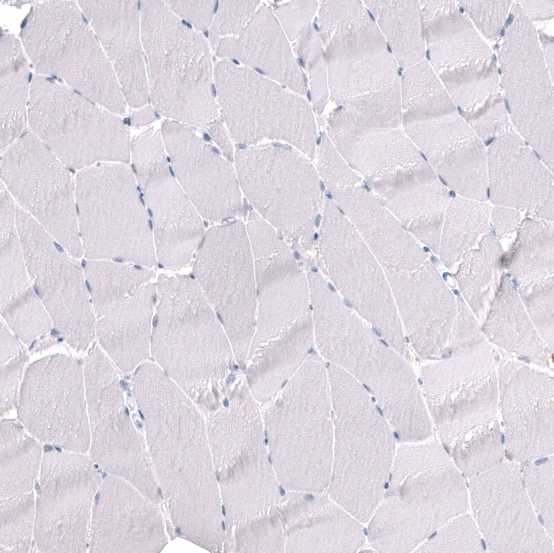 POU3F3 Antibody (CL15302) [Unconjugated] Immunohistochemistry-Paraffin: POU3F3 Antibody (CL15302) [NBP3-43659]