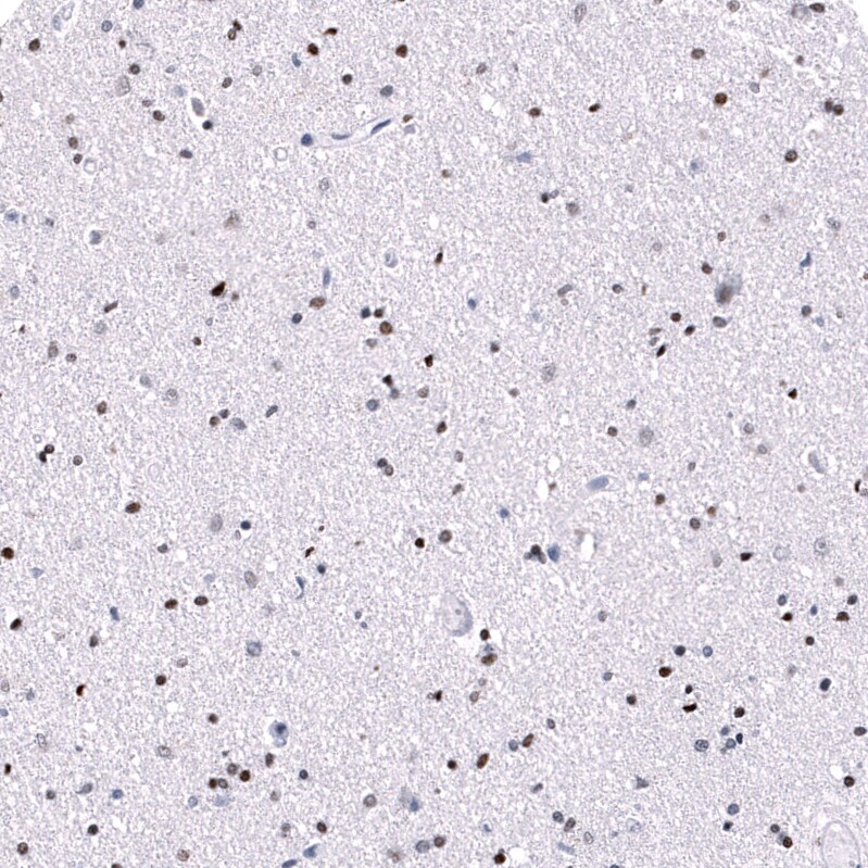 POU3F3 Antibody (CL15302) [Unconjugated] Immunohistochemistry-Paraffin: POU3F3 Antibody (CL15302) [NBP3-43659]