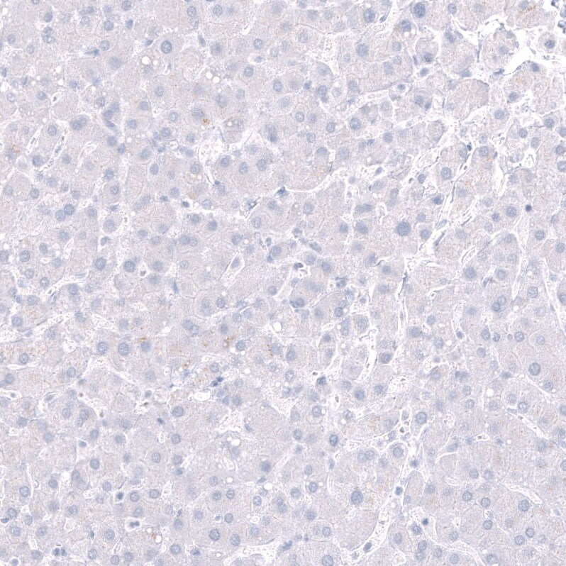 POU3F3 Antibody (CL15302) [Unconjugated] Immunohistochemistry-Paraffin: POU3F3 Antibody (CL15302) [NBP3-43659]