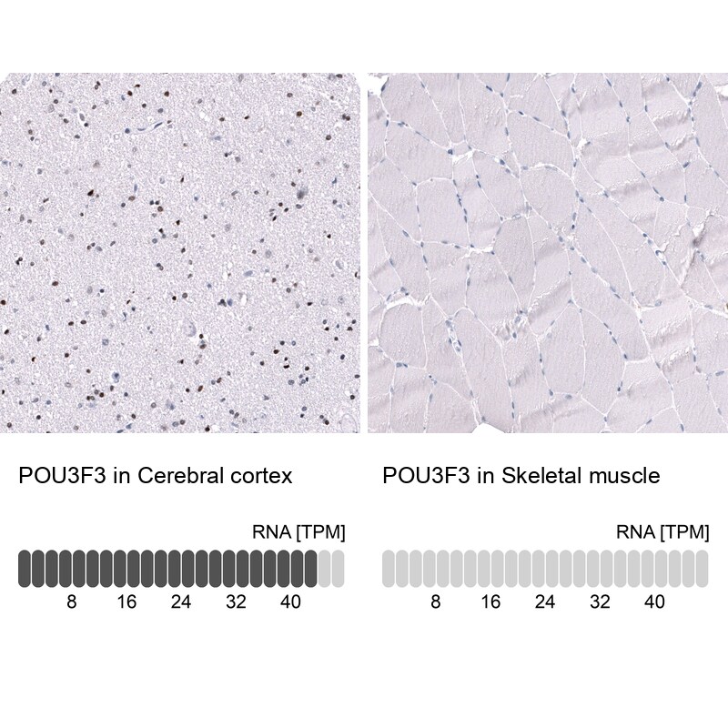 POU3F3 Antibody (CL15302) [Unconjugated] Immunohistochemistry-Paraffin: POU3F3 Antibody (CL15302) [NBP3-43659]