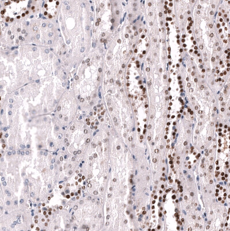 POU3F3 Antibody (CL15308) [Unconjugated] Immunohistochemistry-Paraffin: POU3F3 Antibody (CL15308) [NBP3-43660]