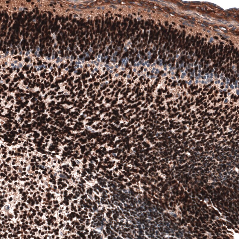 POU3F3 Antibody (CL15308) [Unconjugated] Immunohistochemistry-Paraffin: POU3F3 Antibody (CL15308) [NBP3-43660]