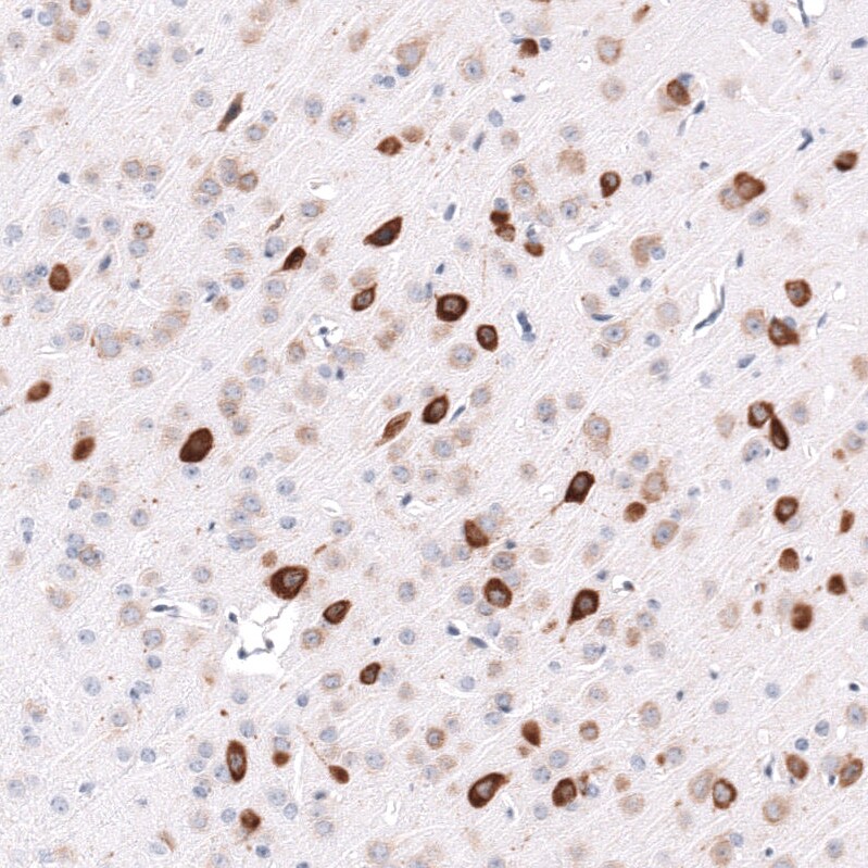 ELAVL2 Antibody (CL15323) [Unconjugated] Immunohistochemistry-Paraffin: ELAVL2 Antibody (CL15323) [NBP3-43661]