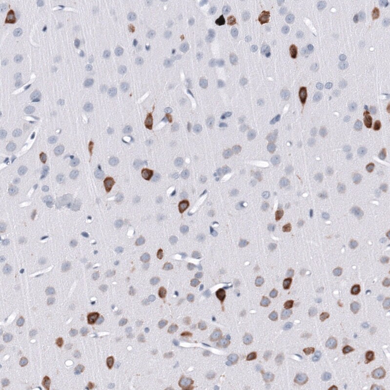 ELAVL2 Antibody (CL15323) [Unconjugated] Immunohistochemistry-Paraffin: ELAVL2 Antibody (CL15323) [NBP3-43661]