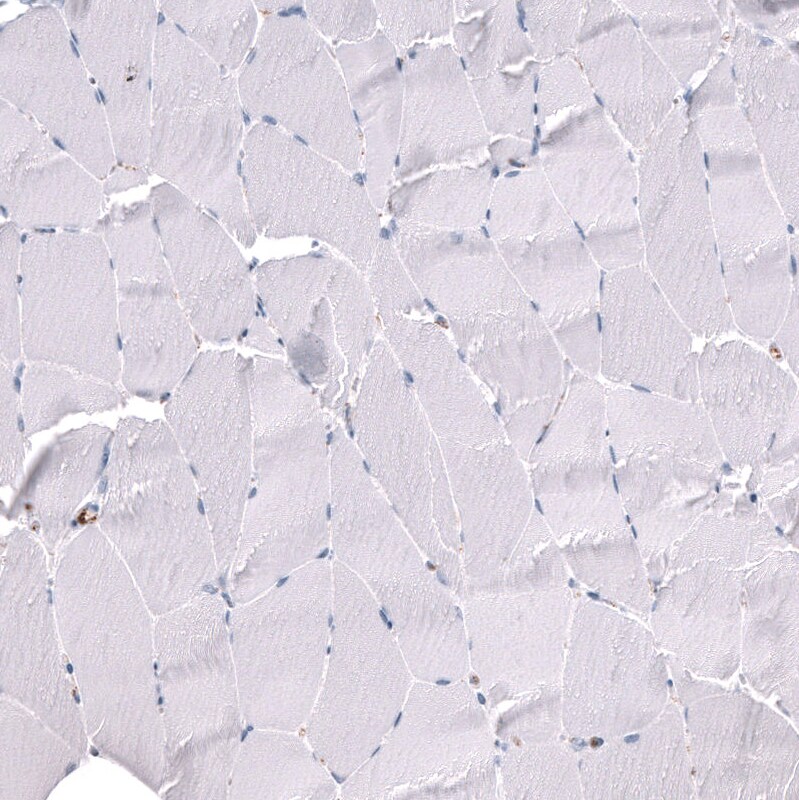 ELAVL2 Antibody (CL15323) [Unconjugated] Immunohistochemistry-Paraffin: ELAVL2 Antibody (CL15323) [NBP3-43661]