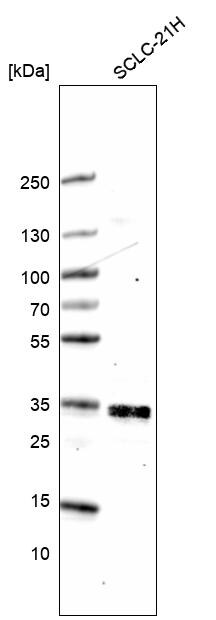 ELAVL2 Antibody (CL15323) [Unconjugated] Western blot: ELAVL2 Antibody (CL15323) [NBP3-43661]