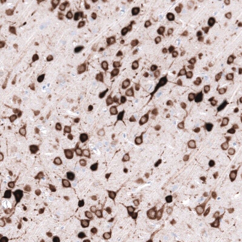 ELAVL2 Antibody (CL15329) [Unconjugated] Immunohistochemistry-Paraffin: ELAVL2 Antibody (CL15329) [NBP3-43662]