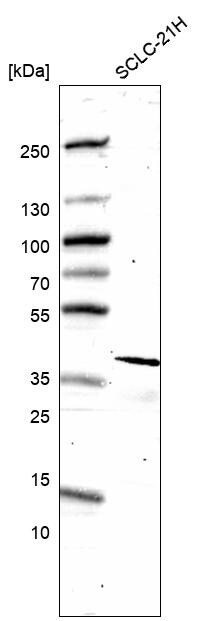 ELAVL2 Antibody (CL15329) [Unconjugated] Western blot: ELAVL2 Antibody (CL15329) [NBP3-43662]