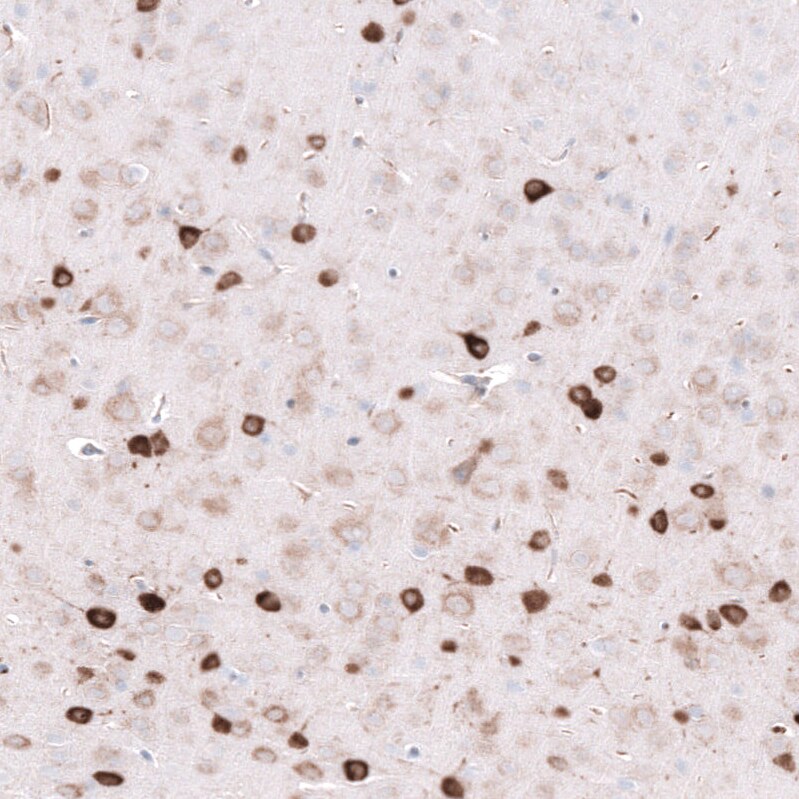 ELAVL2 Antibody (CL15329) [Unconjugated] Immunohistochemistry-Paraffin: ELAVL2 Antibody (CL15329) [NBP3-43662]