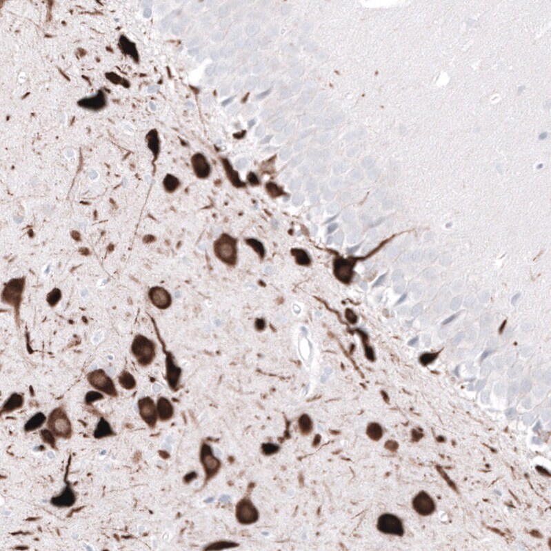 ELAVL2 Antibody (CL15329) [Unconjugated] Immunohistochemistry-Paraffin: ELAVL2 Antibody (CL15329) [NBP3-43662]