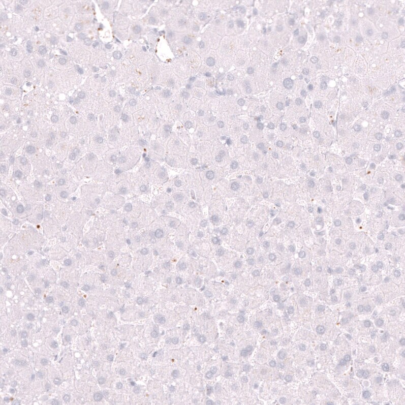 ELAVL2 Antibody (CL15329) [Unconjugated] Immunohistochemistry-Paraffin: ELAVL2 Antibody (CL15329) [NBP3-43662]