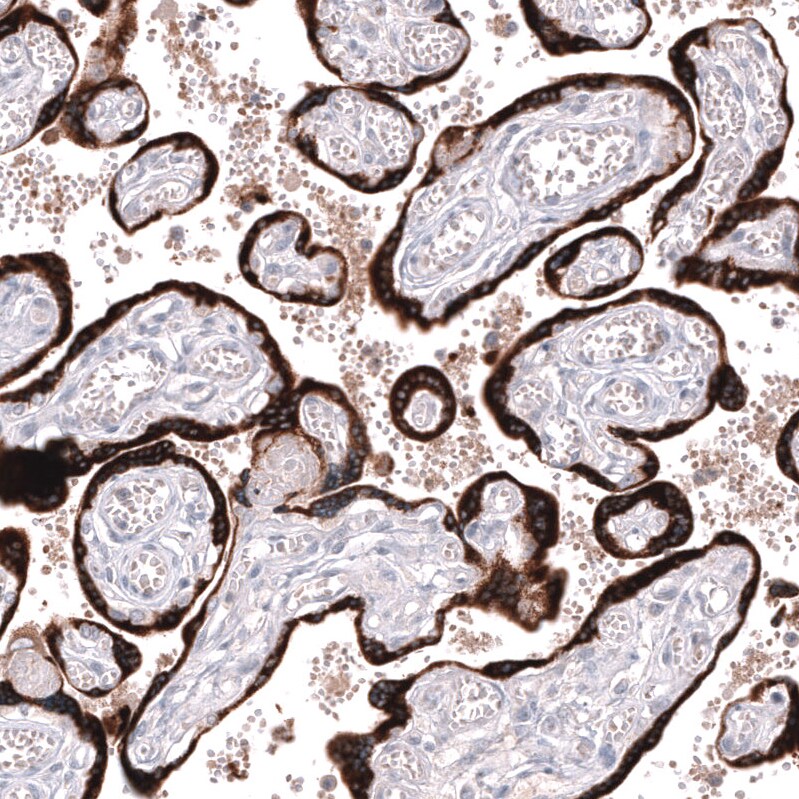 Inhibin beta A Antibody (CL15357) [Unconjugated] Immunohistochemistry-Paraffin: Inhibin beta A Antibody (CL15357) [NBP3-43663]