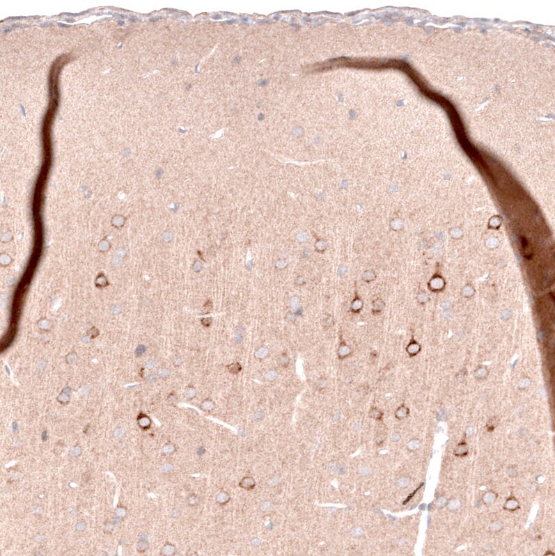 Inhibin beta A Antibody (CL15357) [Unconjugated] Immunohistochemistry-Paraffin: Inhibin beta A Antibody (CL15357) [NBP3-43663]