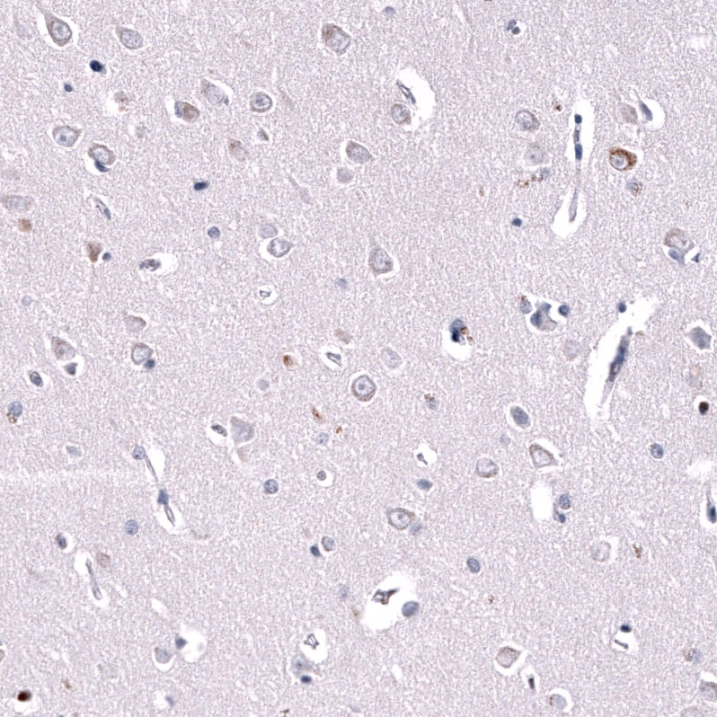Inhibin beta A Antibody (CL15357) [Unconjugated] Immunohistochemistry-Paraffin: Inhibin beta A Antibody (CL15357) [NBP3-43663]