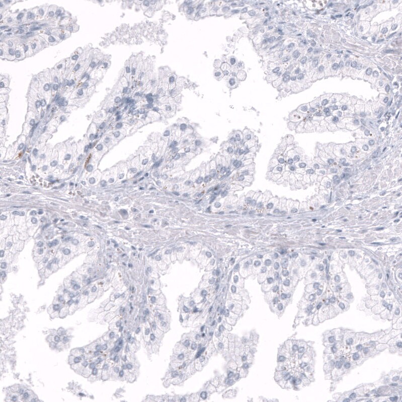 Inhibin beta A Antibody (CL15357) [Unconjugated] Immunohistochemistry-Paraffin: Inhibin beta A Antibody (CL15357) [NBP3-43663]