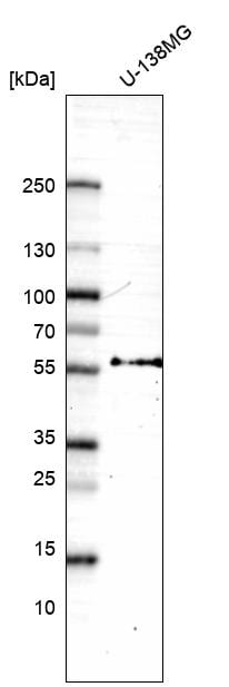 Inhibin beta A Antibody (CL15357) [Unconjugated] Western blot: Inhibin beta A Antibody (CL15357) [NBP3-43663]