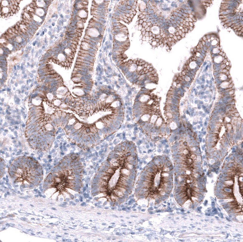 Nectin-3/PVRL3 Antibody (CL15364) [Unconjugated] Immunohistochemistry-Paraffin: Nectin-3/PVRL3 Antibody (CL15364) [NBP3-43664]