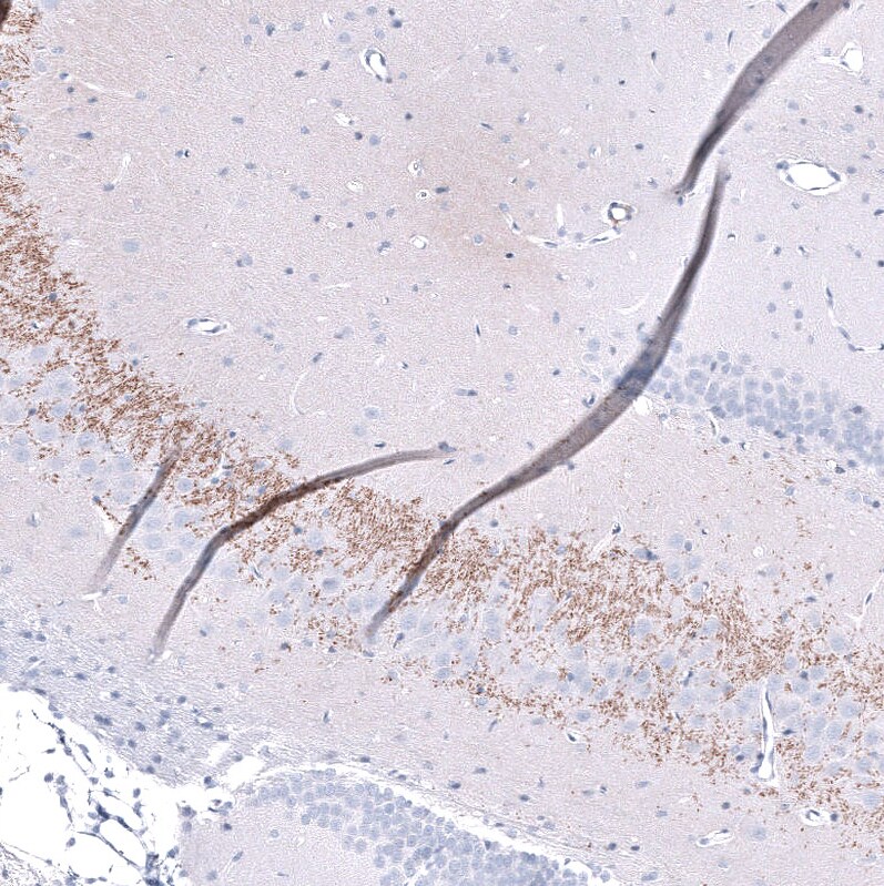 Nectin-3/PVRL3 Antibody (CL15364) [Unconjugated] Immunohistochemistry-Paraffin: Nectin-3/PVRL3 Antibody (CL15364) [NBP3-43664]