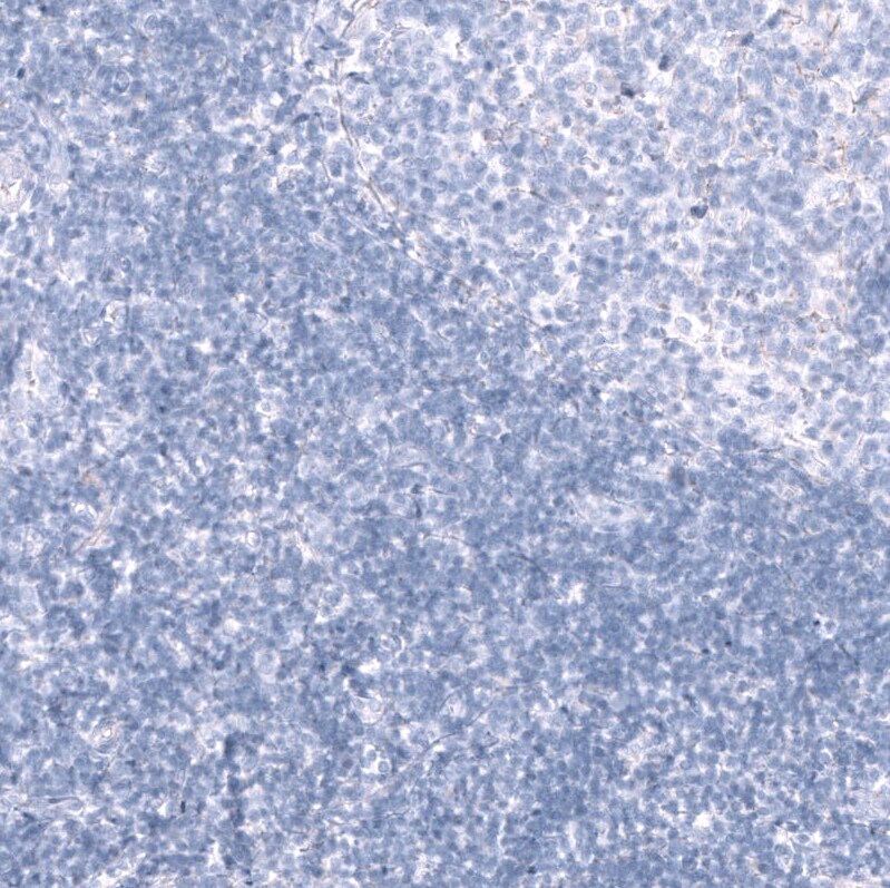 Nectin-3/PVRL3 Antibody (CL15364) [Unconjugated] Immunohistochemistry-Paraffin: Nectin-3/PVRL3 Antibody (CL15364) [NBP3-43664]