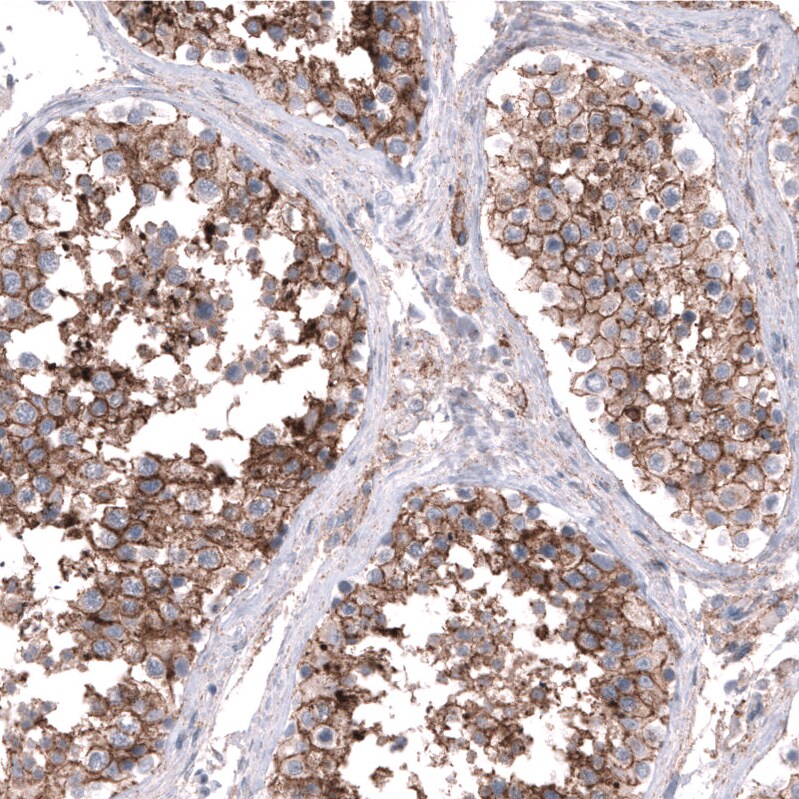 Nectin-3/PVRL3 Antibody (CL15366) [Unconjugated] Immunohistochemistry-Paraffin: Nectin-3/PVRL3 Antibody (CL15366) [NBP3-43665]