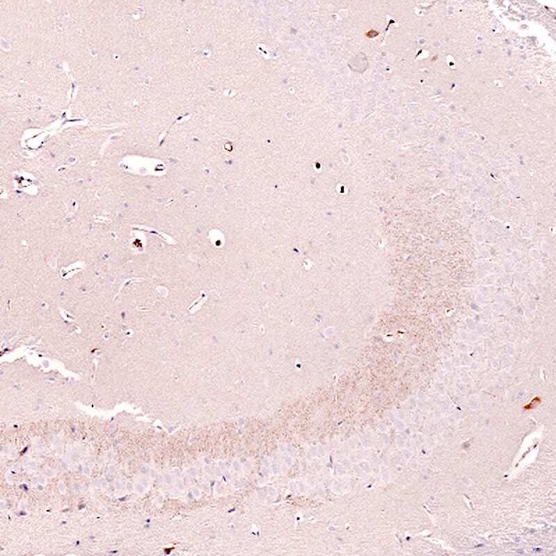 Nectin-3/PVRL3 Antibody (CL15366) [Unconjugated] Immunohistochemistry-Paraffin: Nectin-3/PVRL3 Antibody (CL15366) [NBP3-43665]