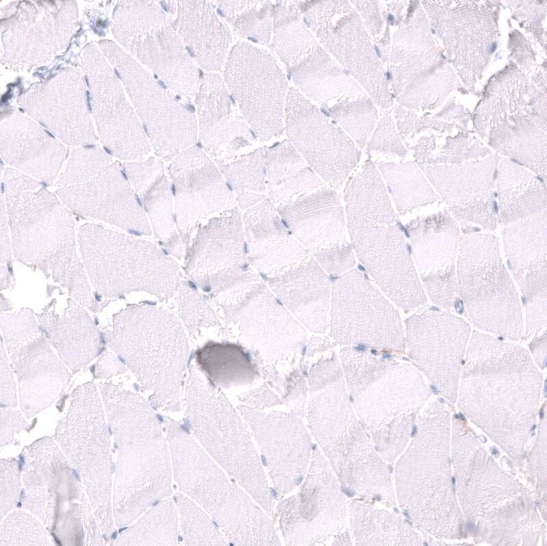 Nectin-3/PVRL3 Antibody (CL15366) [Unconjugated] Immunohistochemistry-Paraffin: Nectin-3/PVRL3 Antibody (CL15366) [NBP3-43665]
