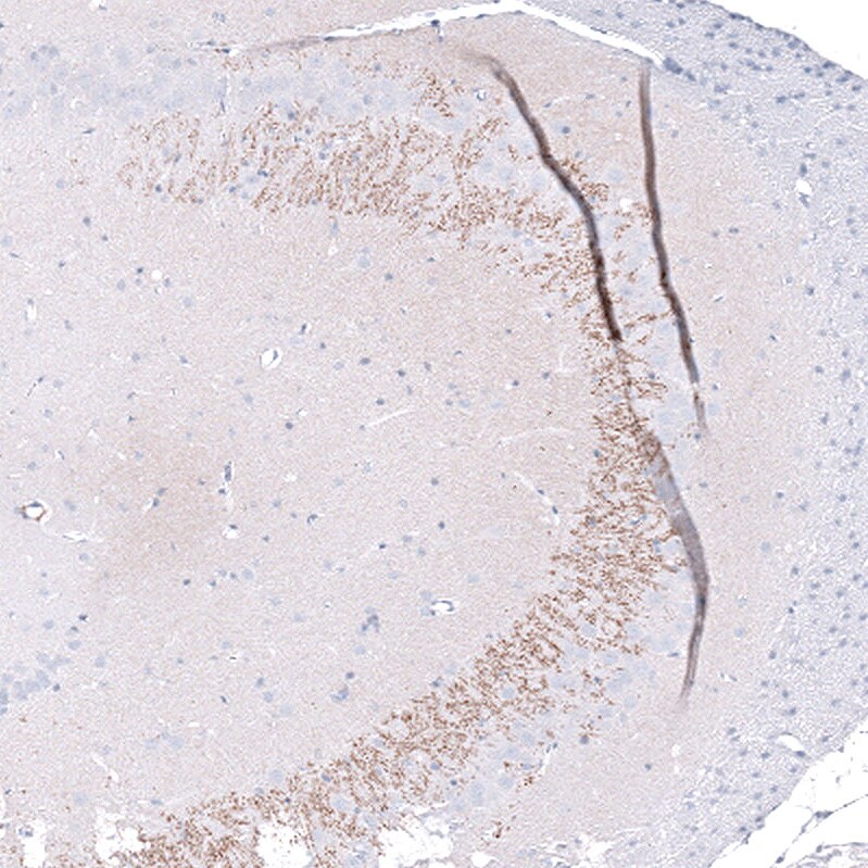 Nectin-3/PVRL3 Antibody (CL15366) [Unconjugated] Immunohistochemistry-Paraffin: Nectin-3/PVRL3 Antibody (CL15366) [NBP3-43665]
