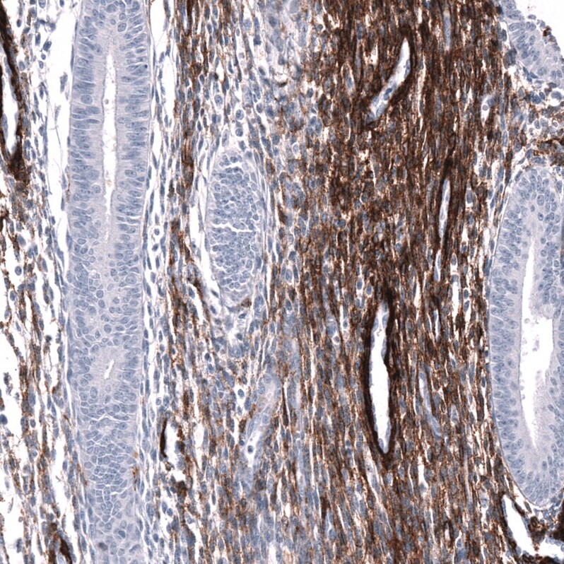 Cadherin-13 Antibody (CL15368) [Unconjugated] Immunohistochemistry-Paraffin: Cadherin-13 Antibody (CL15368) [NBP3-43666]
