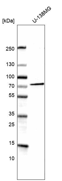 Cadherin-13 Antibody (CL15368) [Unconjugated] Western blot: Cadherin-13 Antibody (CL15368) [NBP3-43666]
