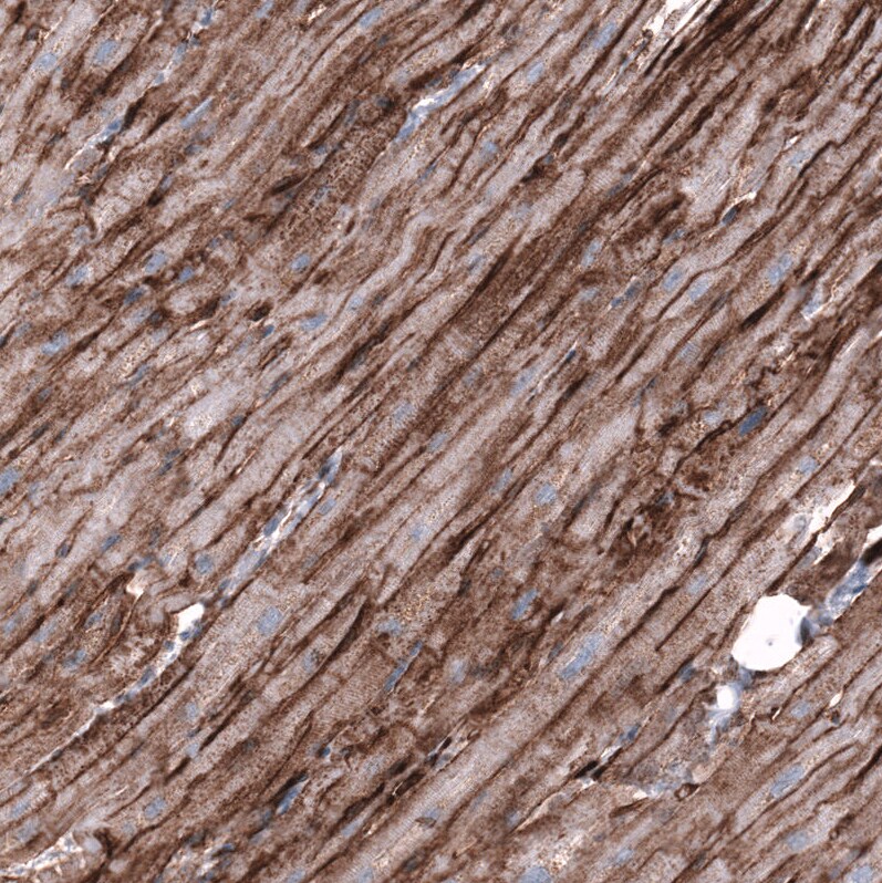 Cadherin-13 Antibody (CL15368) [Unconjugated] Immunohistochemistry-Paraffin: Cadherin-13 Antibody (CL15368) [NBP3-43666]