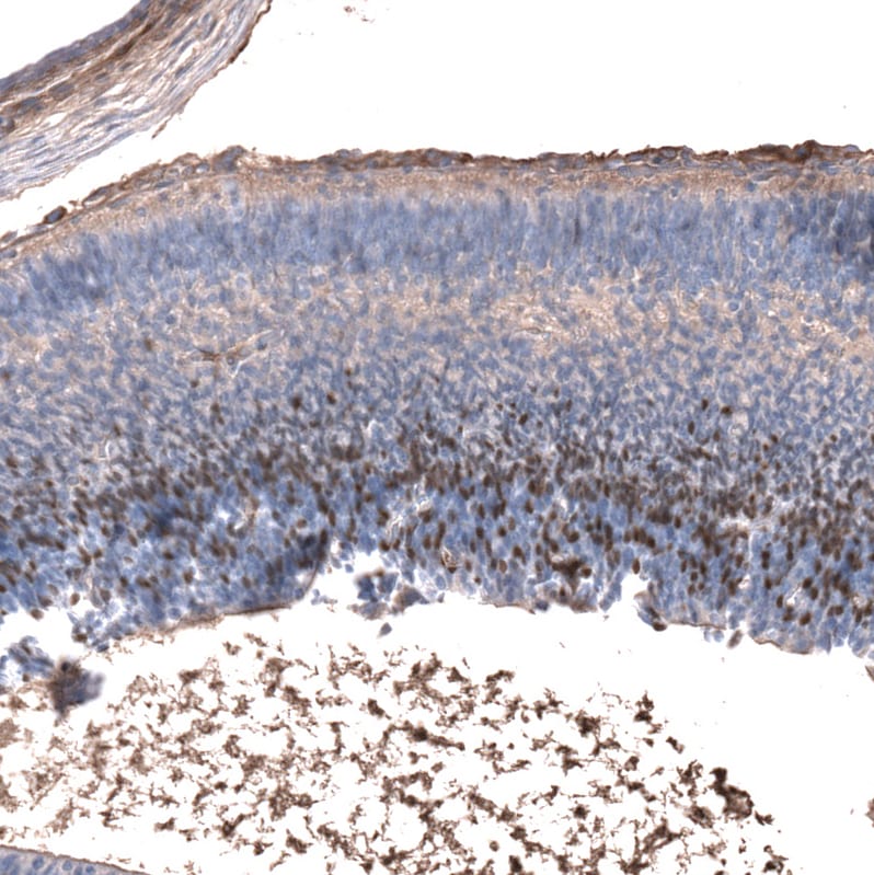 EOMES Antibody (CL15425) [Unconjugated] Immunohistochemistry-Paraffin: EOMES Antibody (CL15425) [NBP3-43667]