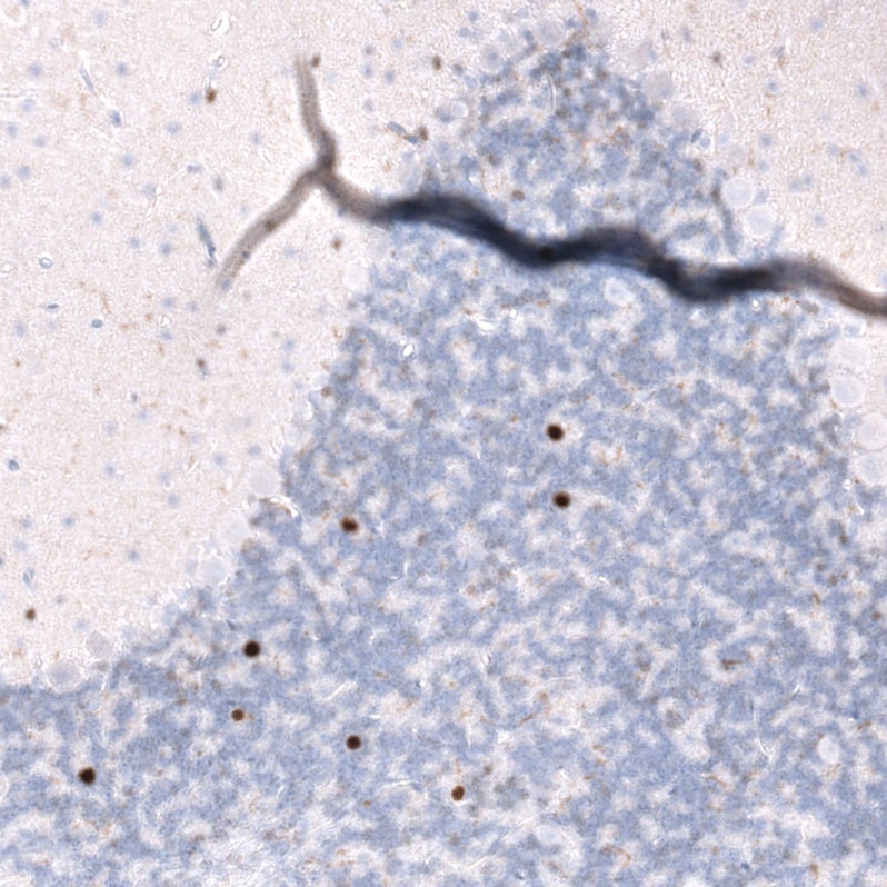 EOMES Antibody (CL15425) [Unconjugated] Immunohistochemistry-Paraffin: EOMES Antibody (CL15425) [NBP3-43667]