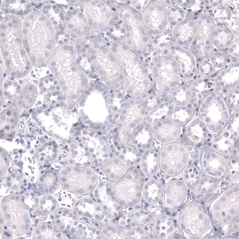 EOMES Antibody (CL15426) [Unconjugated] Immunohistochemistry-Paraffin: EOMES Antibody (CL15426) [NBP3-43668]