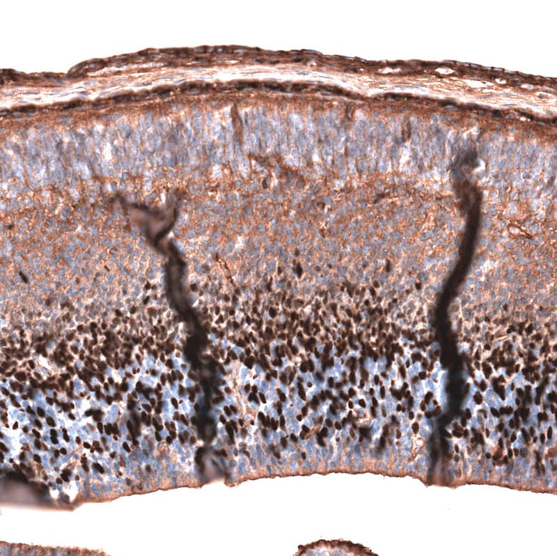 EOMES Antibody (CL15426) [Unconjugated] Immunohistochemistry-Paraffin: EOMES Antibody (CL15426) [NBP3-43668]