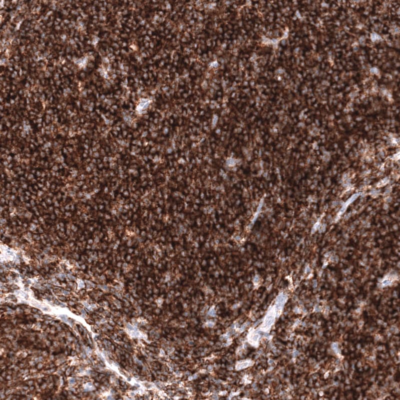 CD19 Antibody (CL15454) [Unconjugated] Immunohistochemistry-Paraffin: CD19 Antibody (CL15454) [NBP3-43669]