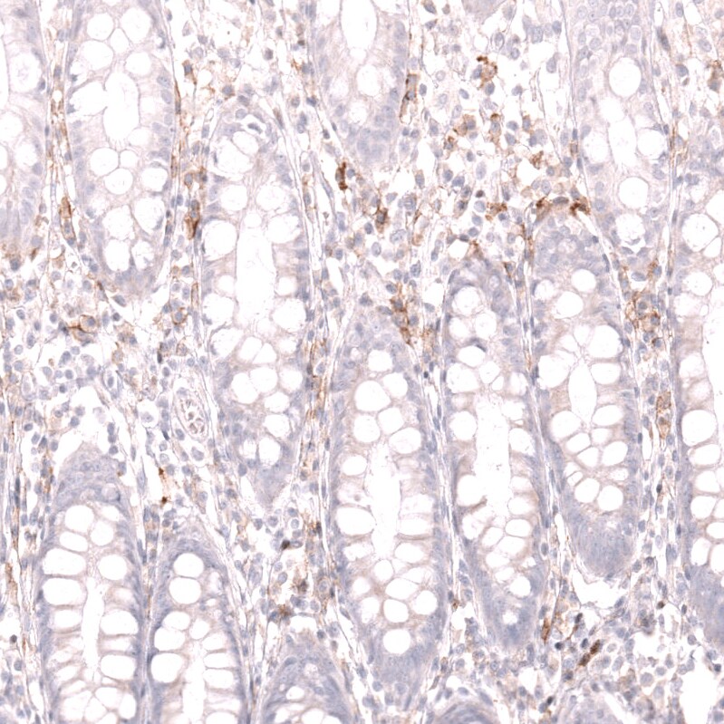 CD19 Antibody (CL15454) [Unconjugated] Immunohistochemistry-Paraffin: CD19 Antibody (CL15454) [NBP3-43669]