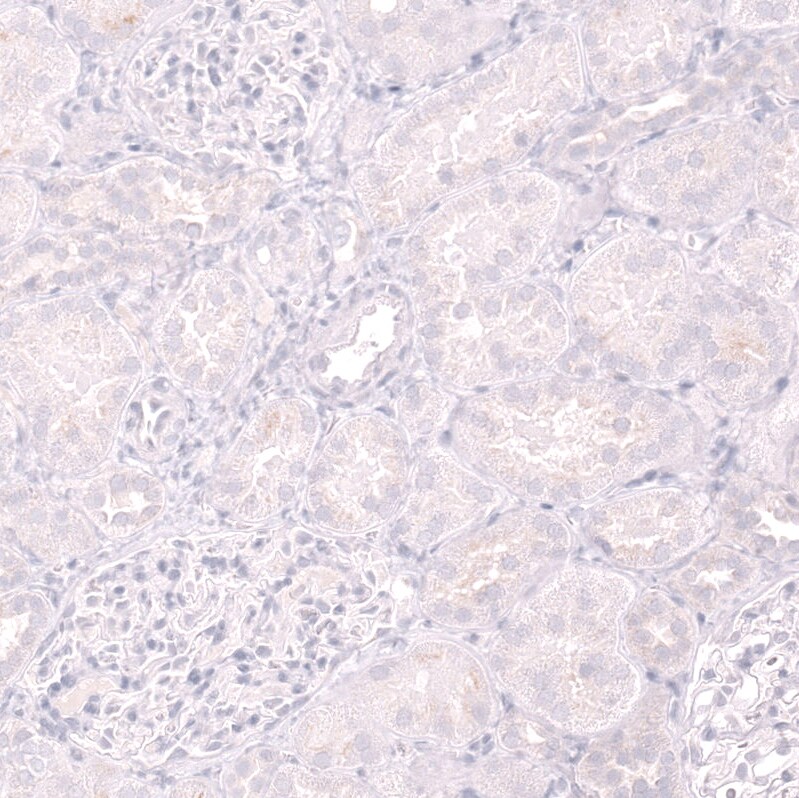 CD19 Antibody (CL15454) [Unconjugated] Immunohistochemistry-Paraffin: CD19 Antibody (CL15454) [NBP3-43669]