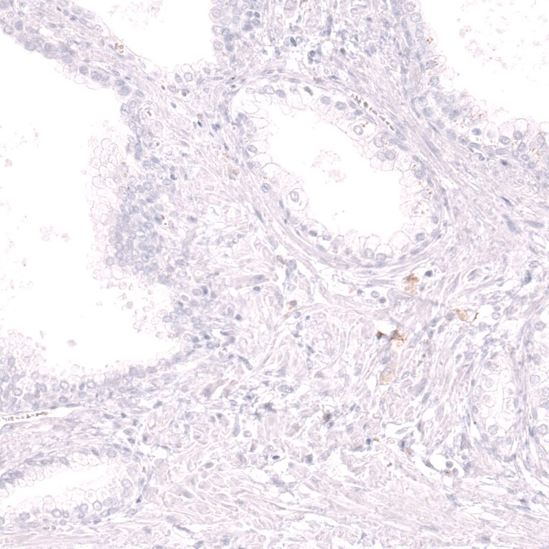 CD19 Antibody (CL15454) [Unconjugated] Immunohistochemistry-Paraffin: CD19 Antibody (CL15454) [NBP3-43669]