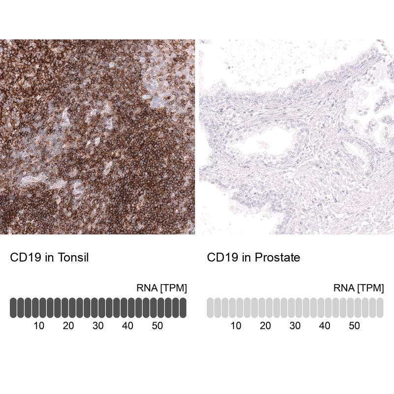 CD19 Antibody (CL15459) [Unconjugated] Immunohistochemistry-Paraffin: CD19 Antibody (CL15459) [NBP3-43670]