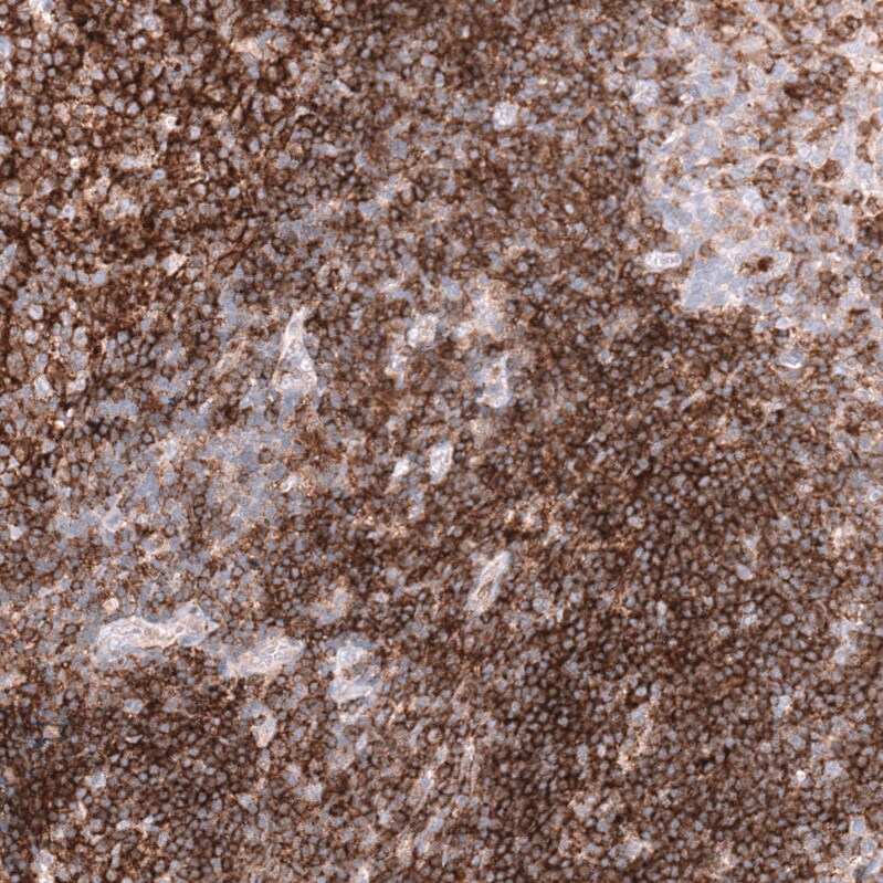 CD19 Antibody (CL15459) [Unconjugated] Immunohistochemistry-Paraffin: CD19 Antibody (CL15459) [NBP3-43670]