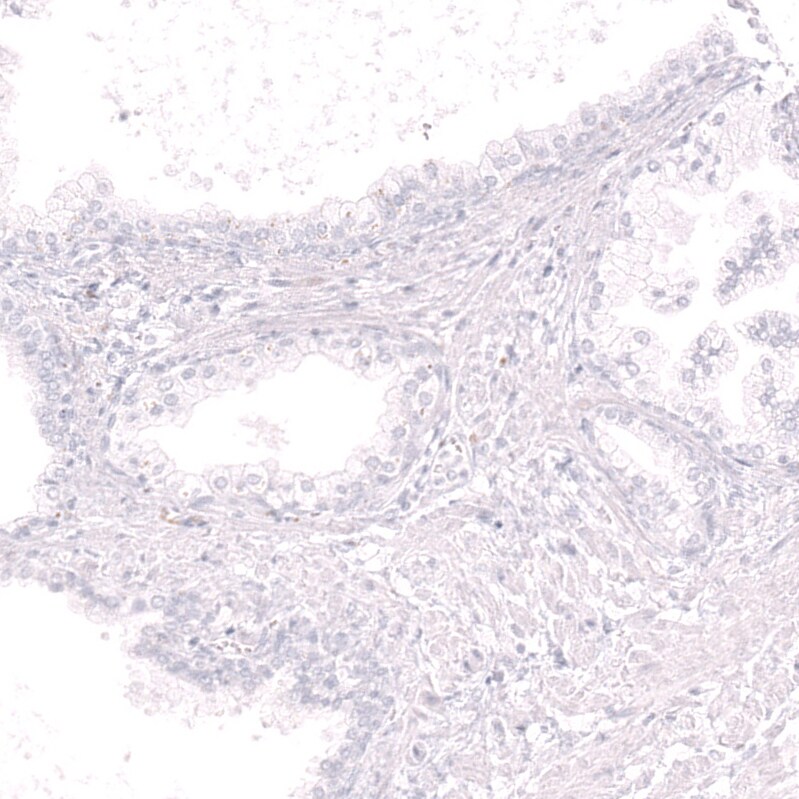 CD19 Antibody (CL15459) [Unconjugated] Immunohistochemistry-Paraffin: CD19 Antibody (CL15459) [NBP3-43670]