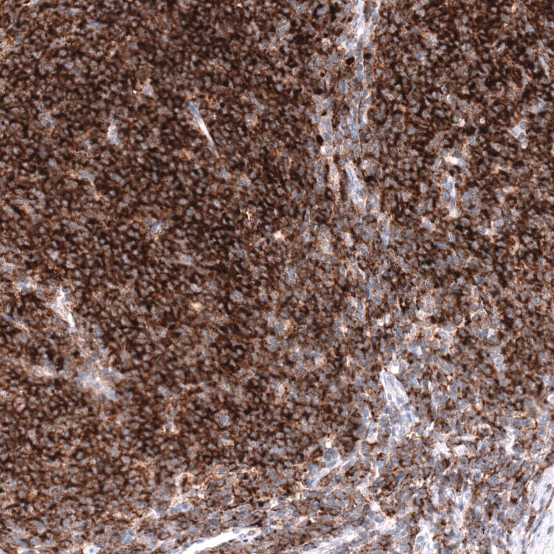 CD19 Antibody (CL15459) [Unconjugated] Immunohistochemistry-Paraffin: CD19 Antibody (CL15459) [NBP3-43670]