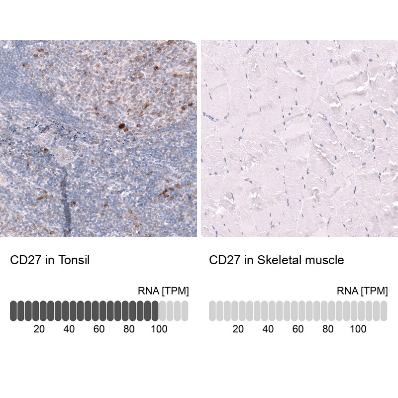CD27/TNFRSF7 Antibody (CL15464) [Unconjugated] Immunohistochemistry-Paraffin: CD27/TNFRSF7 Antibody (CL15464) [NBP3-43671]