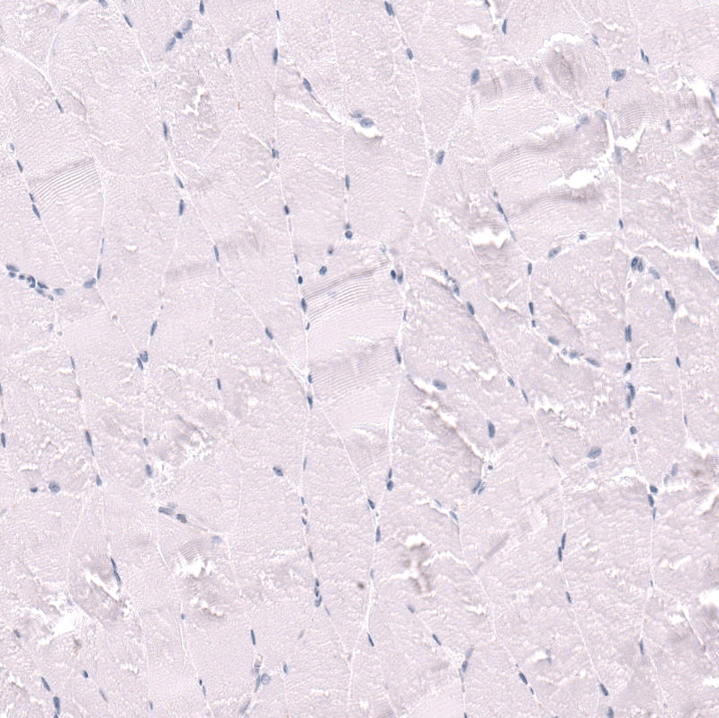 CD27/TNFRSF7 Antibody (CL15464) [Unconjugated] Immunohistochemistry-Paraffin: CD27/TNFRSF7 Antibody (CL15464) [NBP3-43671]